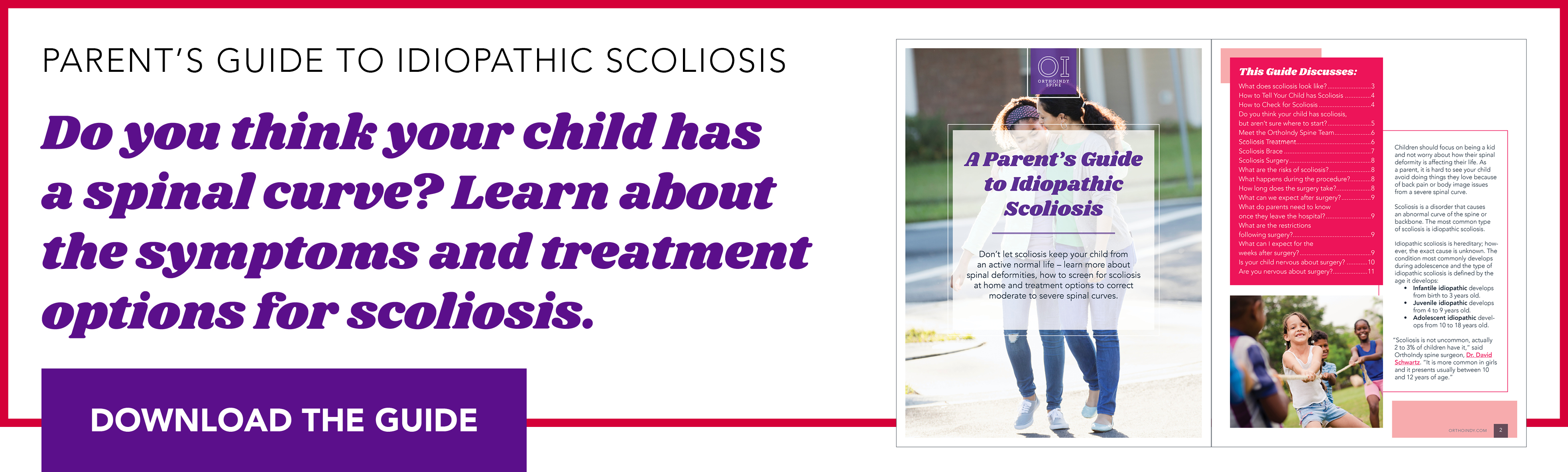 parent guide to idiopathic scoliosis download graphic